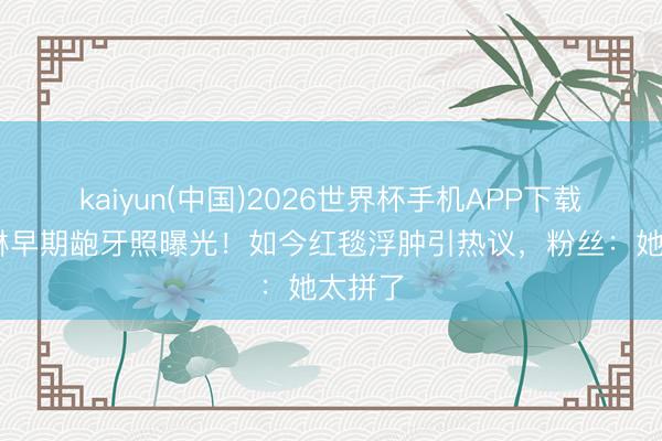 kaiyun(中国)2026世界杯手机APP下载 关之琳早期龅牙照曝光！如今红毯浮肿引热议，粉丝：她太拼了